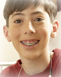 young boy with brand new braces smiling